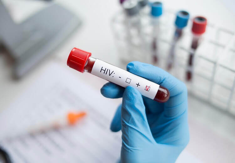 Traitement Post-Exposition au VIH (TPE): que faire en cas de risque ?  - Heyme